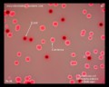 e.coli